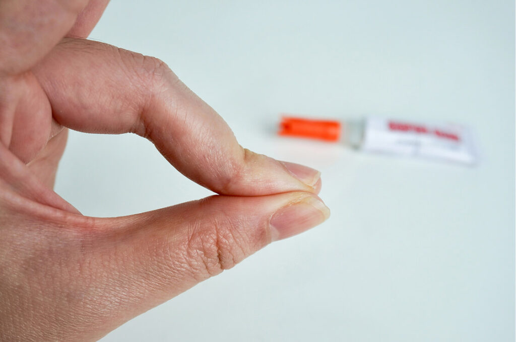 How to get nail glue off skin