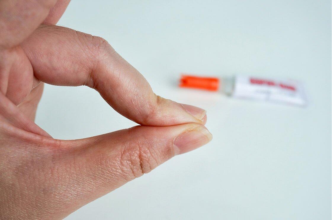 How to get nail glue off skin